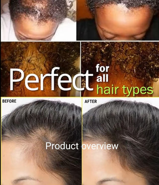 Organic Rosemary Hair Growth Oil