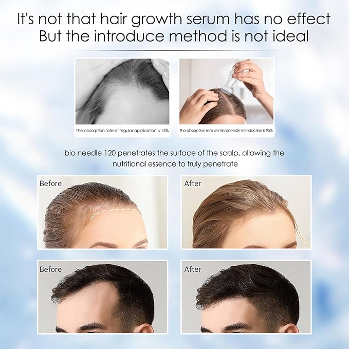 Bio Needle Adjustable Derma Stamp