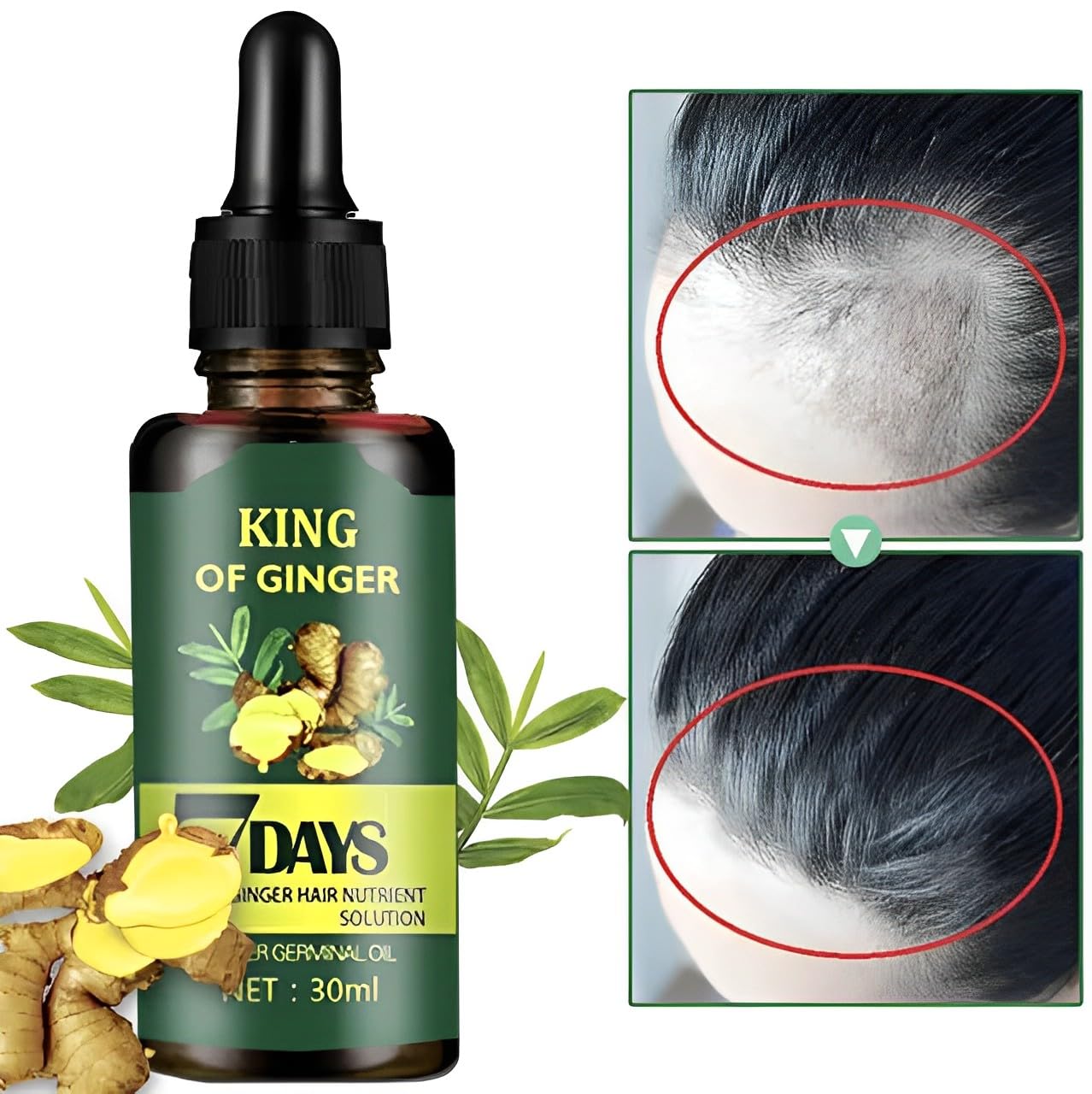 Ginger Germinal Oil, Ginger Hair Growth Oil, Ginger Essential Oil Stop Hair Loss, Supports Healthy Hair, Thinning Hair Treatment Hair Growth Oil for Women & Men 30ML (Pack of 2)