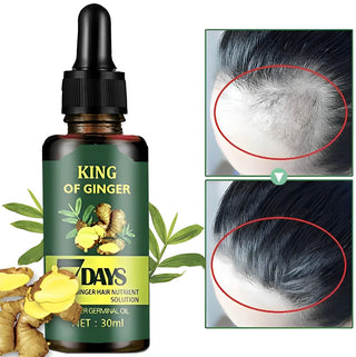 Ginger Germinal Oil, Ginger Hair Growth Oil, Ginger Essential Oil Stop Hair Loss, Supports Healthy Hair, Thinning Hair Treatment Hair Growth Oil for Women & Men 30ML (Pack of 2)